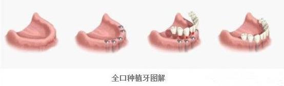 香港精准资料100