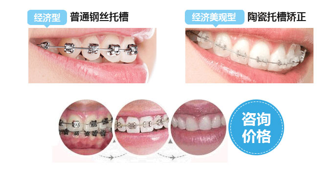 香港精准资料100