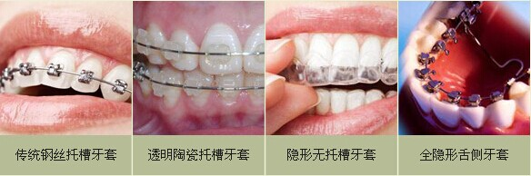香港精准资料100