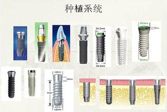 香港精准资料100