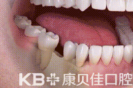 香港精准资料100
