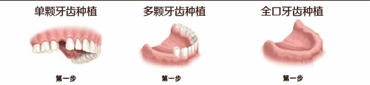 香港精准资料100