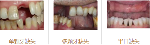 香港精准资料100